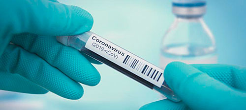 Testing for coronavirus.